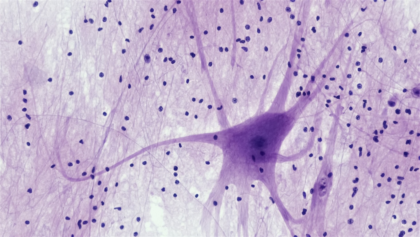 Entendendo a mente: o papel da neuropsicologia